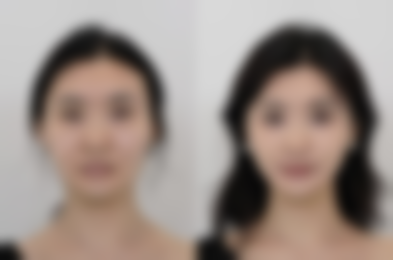 威海可人医疗美容诊所收费标准参考