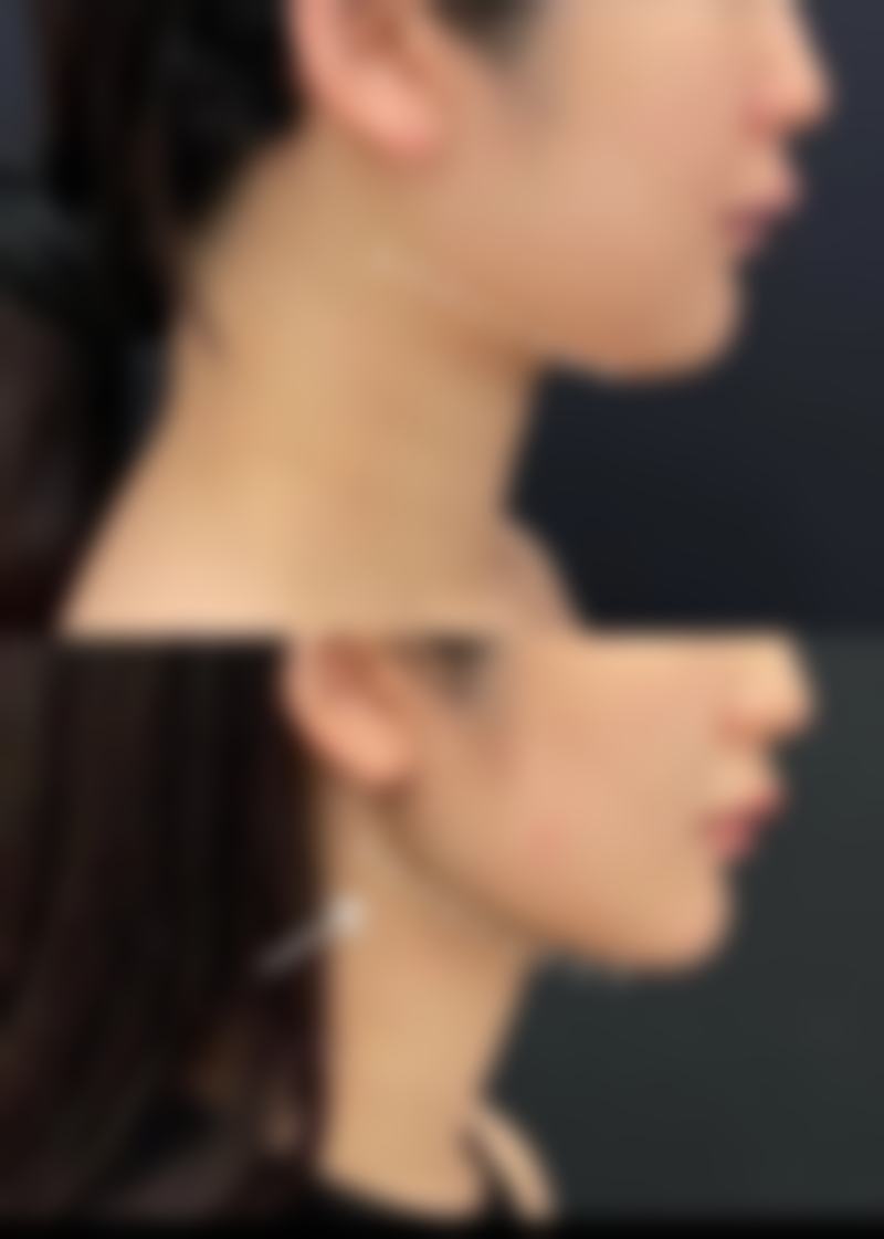 总结——陕西欣薇医疗美容诊所怎么样？