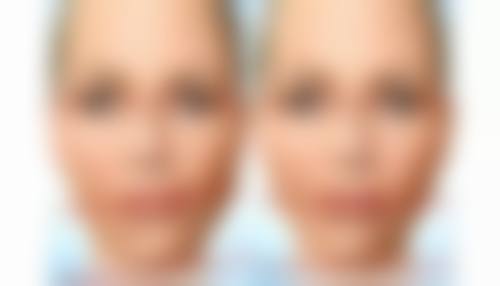 成都卓美色整形医疗美容诊所口碑如何？