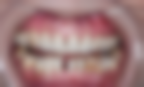 三、山东淄博淄川卓越口腔医生介绍: