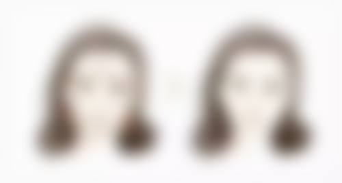 昆山陈医生整形医疗美容诊所收费标准参考