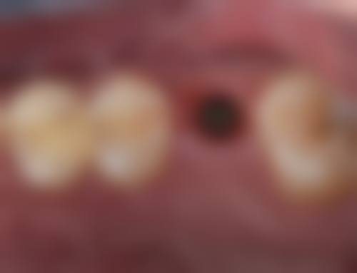 八、钟兆秦医生口腔费用一览表