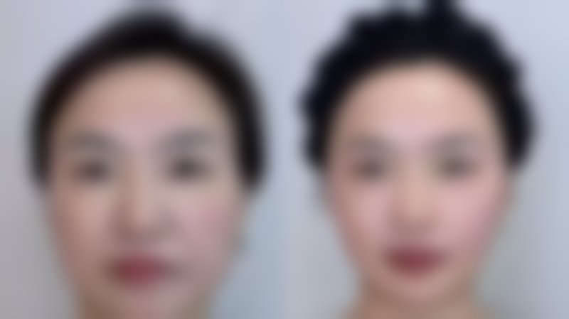 四平吉田医美整形医院医院技术好不好？