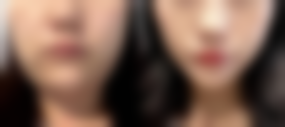 武汉媄妲整形医院陈耀文医生口碑评价如何？