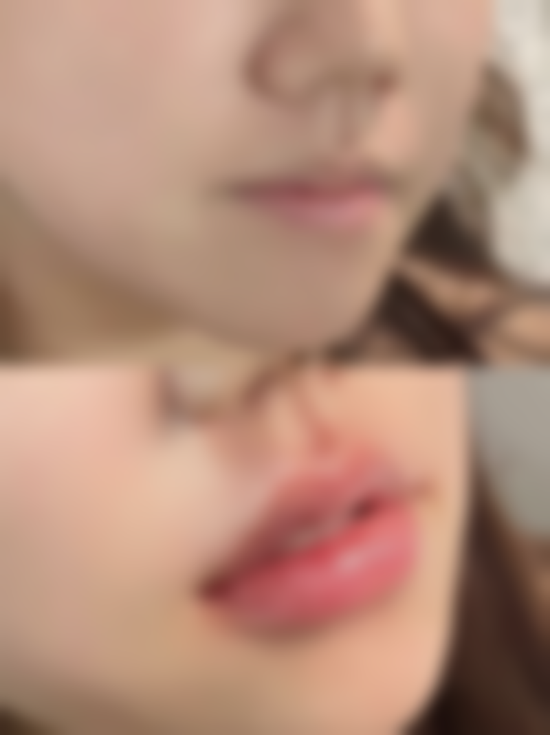 昆山陈医生整形医疗美容诊所口碑如何？