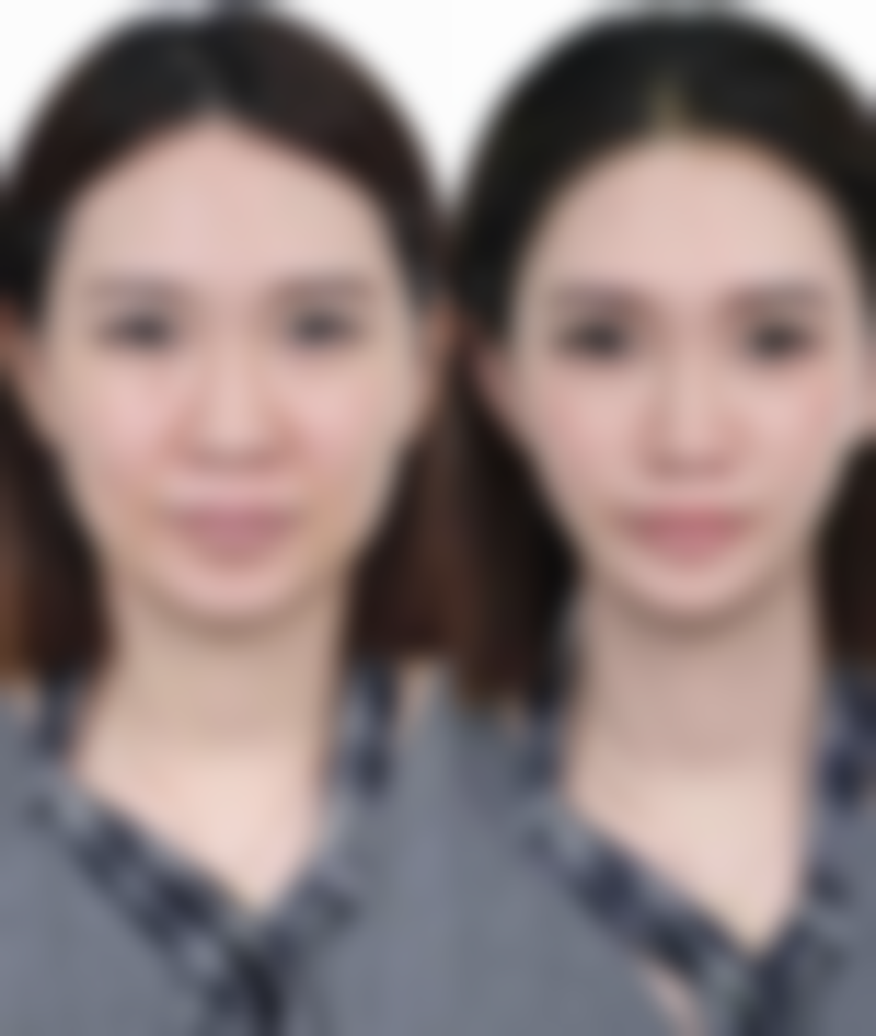 总结——成都卓美色整形医疗美容诊所怎么样？