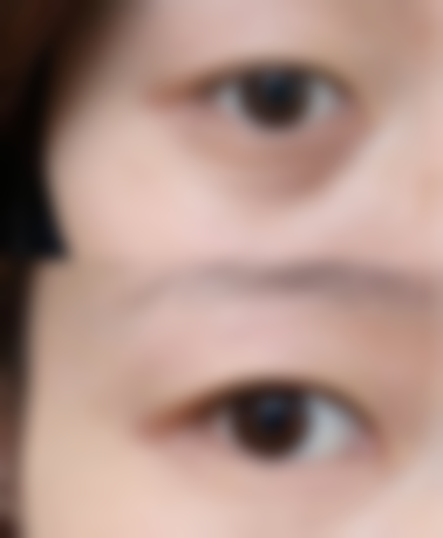 八、云南昆明久龄整形医院用户真实实例