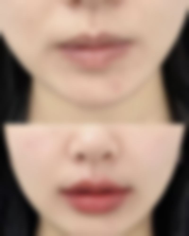 总结——昆山陈医生整形医疗美容诊所怎么样？