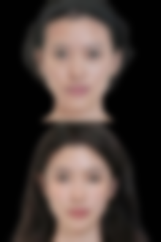 广州慕美整形医疗美容医院口碑如何？