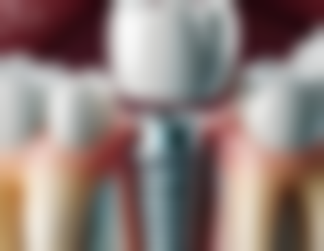 六、山东淄博淄川卓越口腔怎么预约：