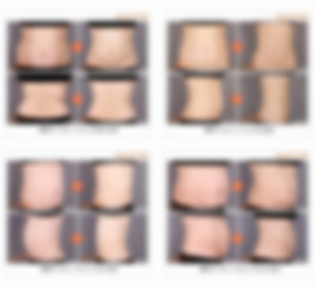 三、何欢（千户兰斯院长）医生在医美领域技术特长