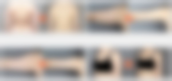 八、何欢（千户兰斯院长）医生医美费用一览表