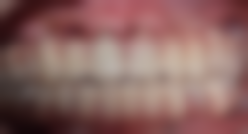 三、张宙医生在口腔领域技术特长