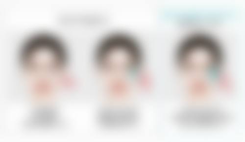 选择恒久隆鼻方式需要考虑什么