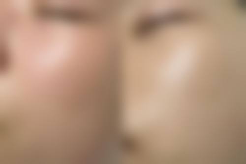 四、广州蛋壳肌因望岗医疗美容诊所开展的项目以及特色项目