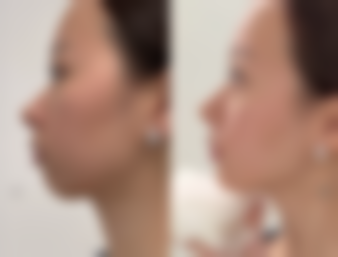 哈尔滨艺星医疗美容医院硬件设备精良！