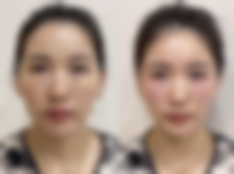 总结——南通星小范医疗美容门诊部怎么样？