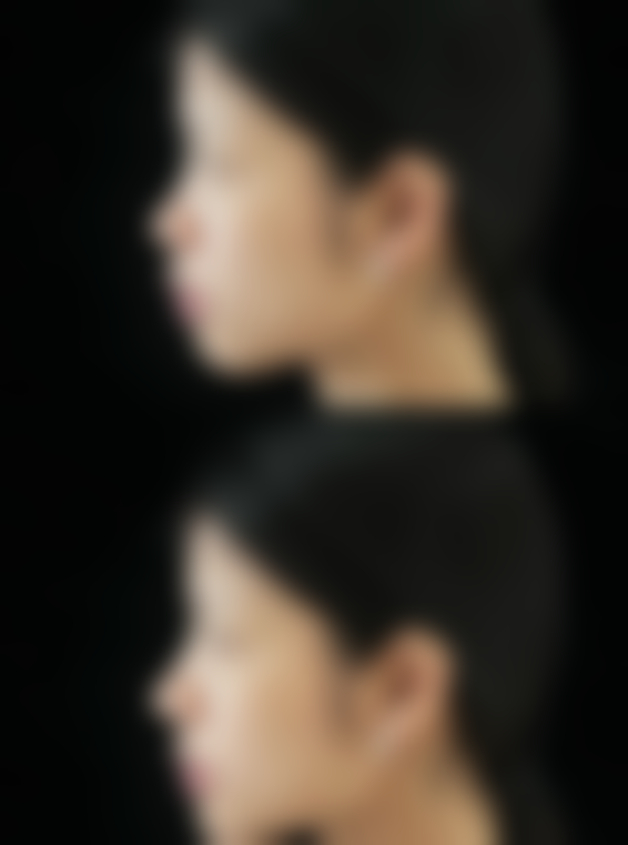 广州利美康粤美医疗美容门诊部霍孟华医生挂号预约攻略