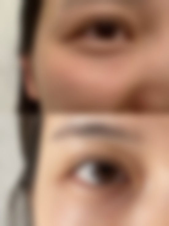 八、广州蛋壳肌因望岗医疗美容诊所用户真实实例