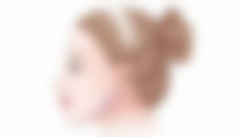 总结——武汉希思特医疗美容医院黄巍医生怎么样？