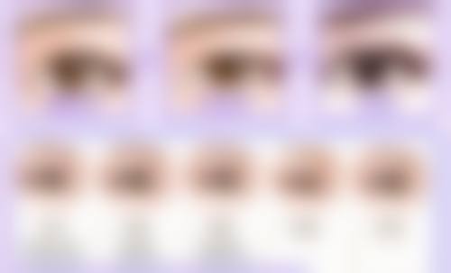 选择注射机构的核心要点