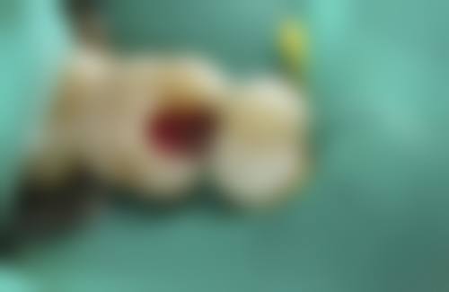 三、刘青东医生在口腔领域技术特长