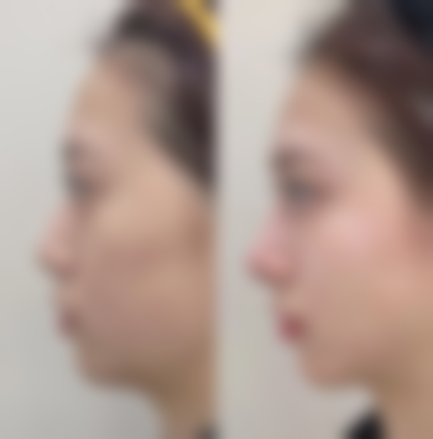 成都朗睿(铂钰)医疗美容诊所地址