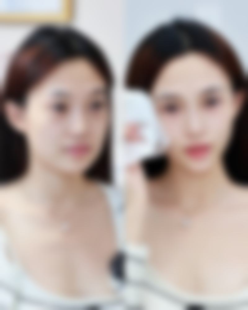 简诗集臻护淡纹眼膜