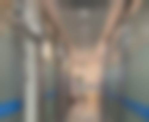 杭州首瑞植发门诊走廊