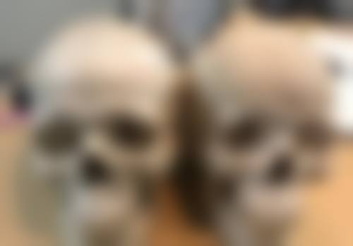 总结——新生植发国内连锁（昆明分店）怎么样？