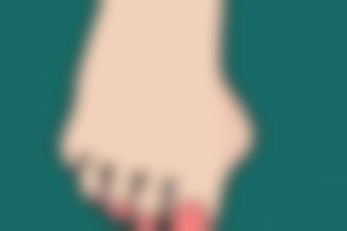 了解增生性疤痕和疤痕疙瘩的区别及医美治疗方法