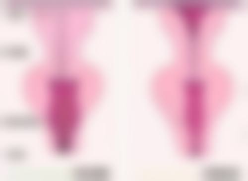 促进烫伤后红色疤痕消退的方法