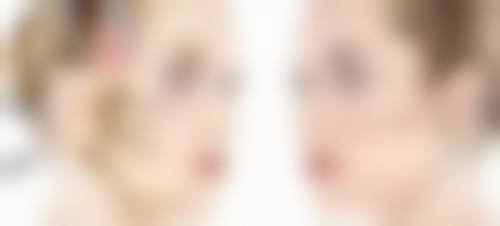 疤痕修复的费用情况