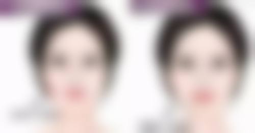 影响吸脂后完全消肿时间的因素