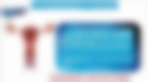 射频除皱维持时间的大致范围