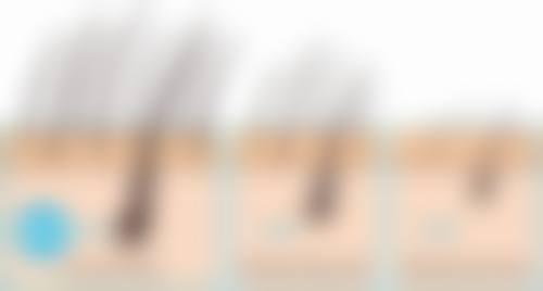 六、合肥新生植发医院怎么预约：