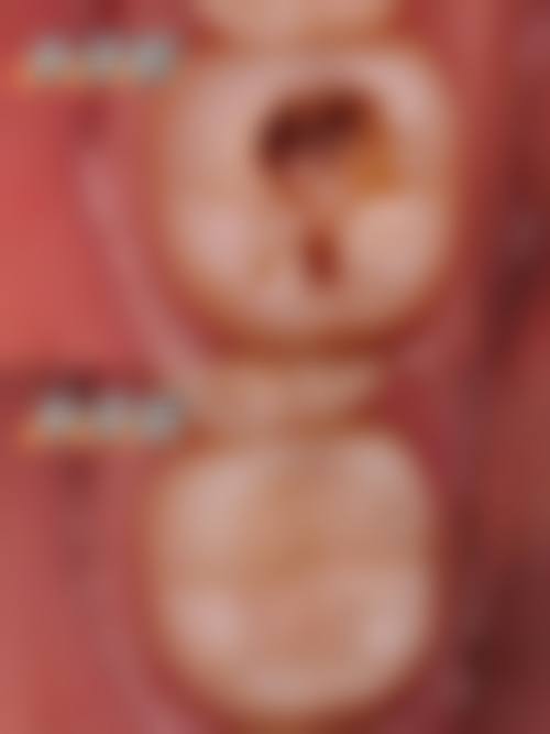 七、日照瑞美口腔门诊部（锦绣花园院区）价格表：（仅供参考）