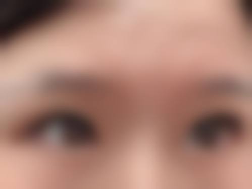 四、合肥新生植发医院开展的项目以及特色项目