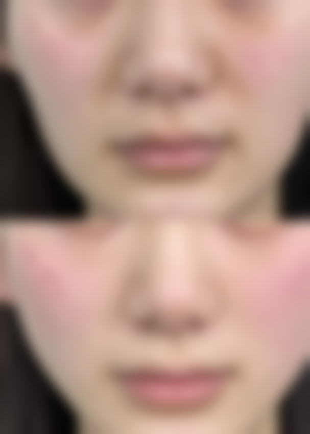 总结——南昌凤凰第一医院怎么样？