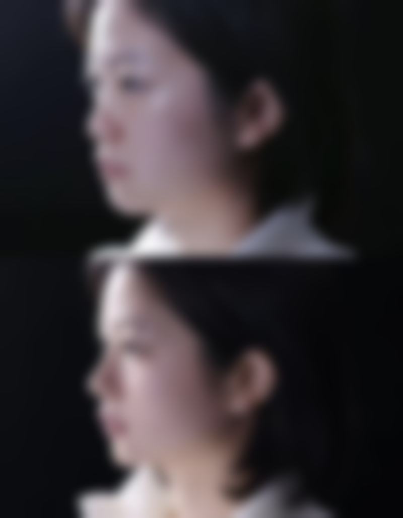 大连鑫来美医疗美容整形医院李荣雨医生挂号预约攻略