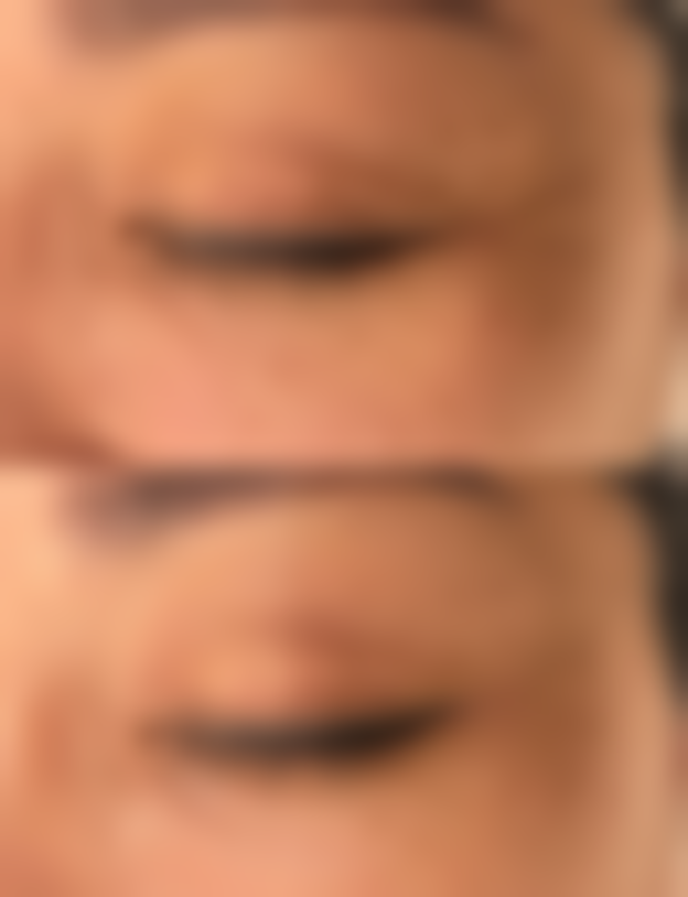 总结——南宁奢梵医疗美容怎么样？