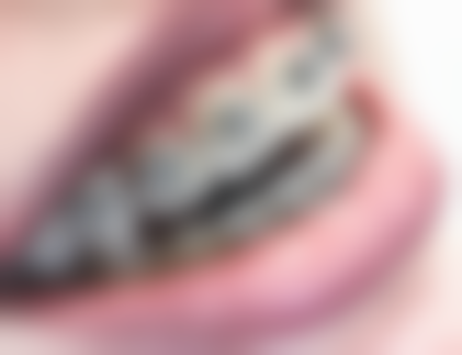 八、日照瑞美口腔门诊部（锦绣花园院区）用户真实实例