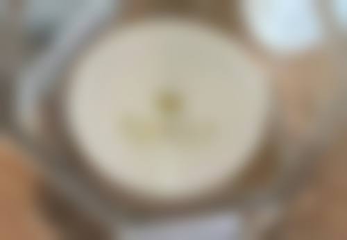 激光和射频治疗消除遗传的眼袋