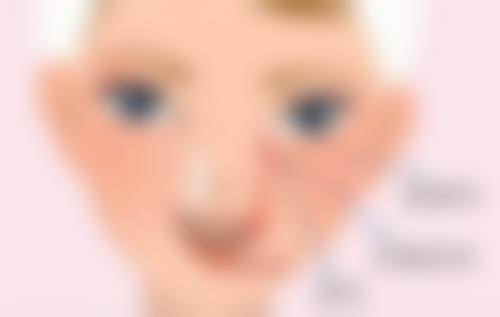 药物治疗凹陷疤痕成效好吗