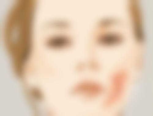 不良生活习惯促使眼袋再次出现