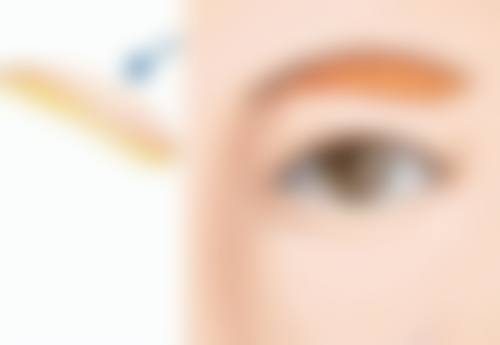 手术治疗修复身上疤痕的方式及注意事项