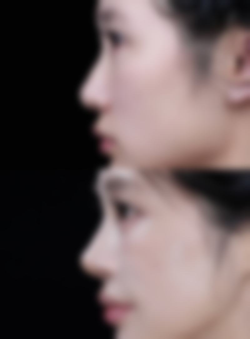 泰州巴宝莉整形医院营业时间