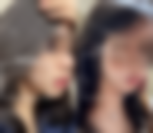 双眼皮修复宽改窄有哪些优势