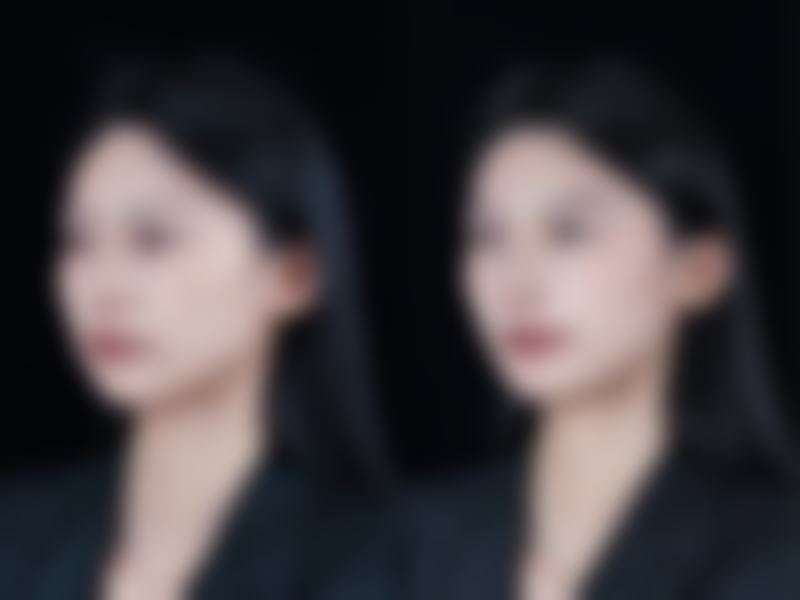 丽江吴氏嘉美整形医院口碑如何？