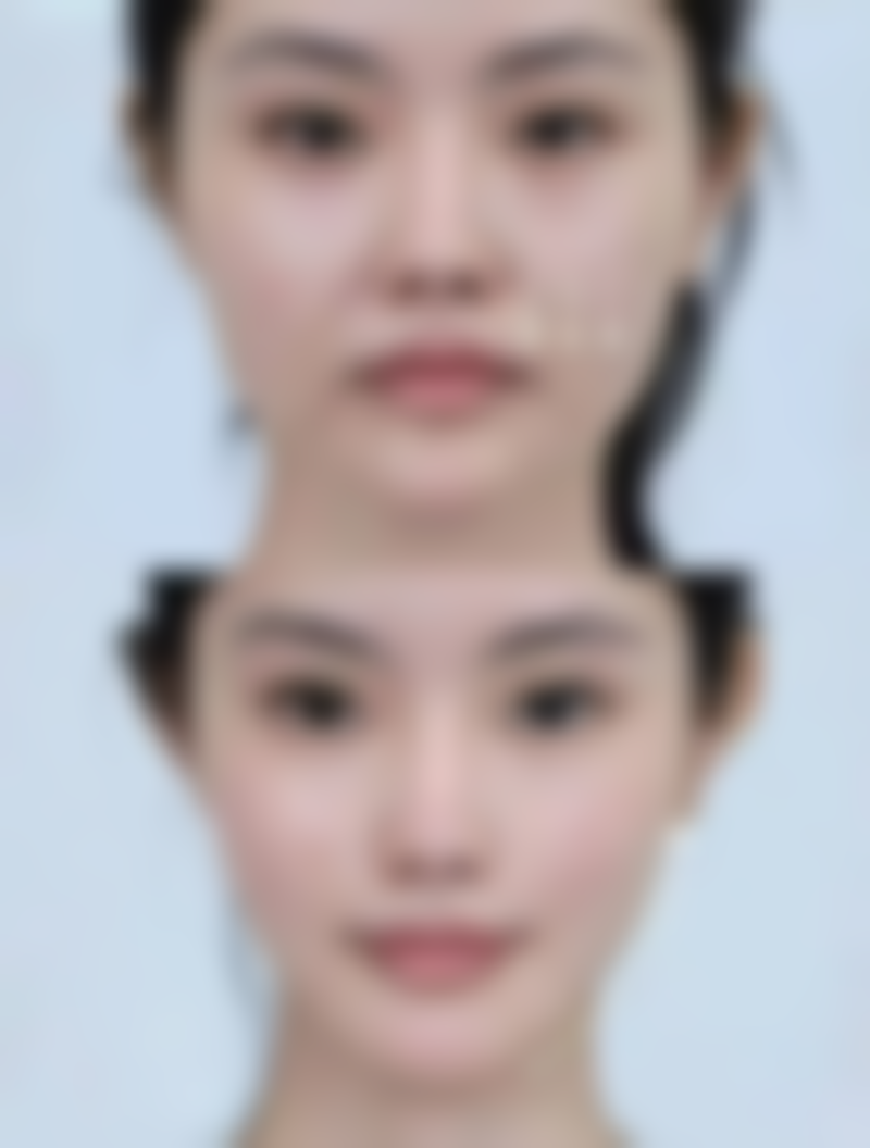 不同双眼皮手术涂睫毛膏的时间